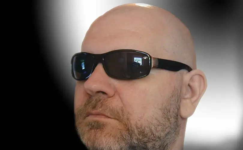 Loss of Hair and Low Testosterone Levels