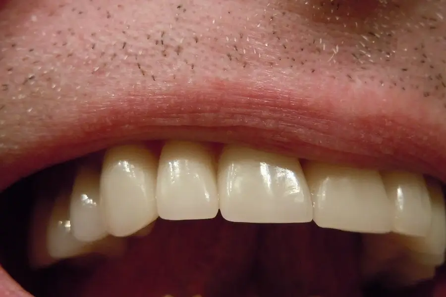 Erectile Dysfunction and Dental Health